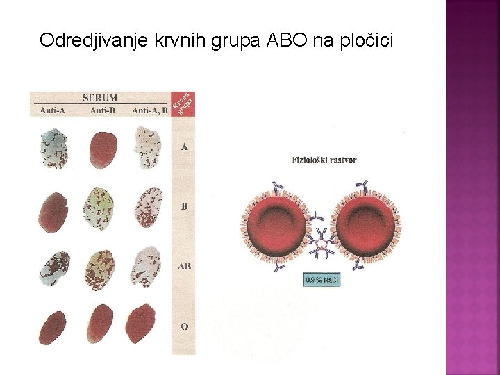 Odredjivanje krvnih grupa ABO na pločici 