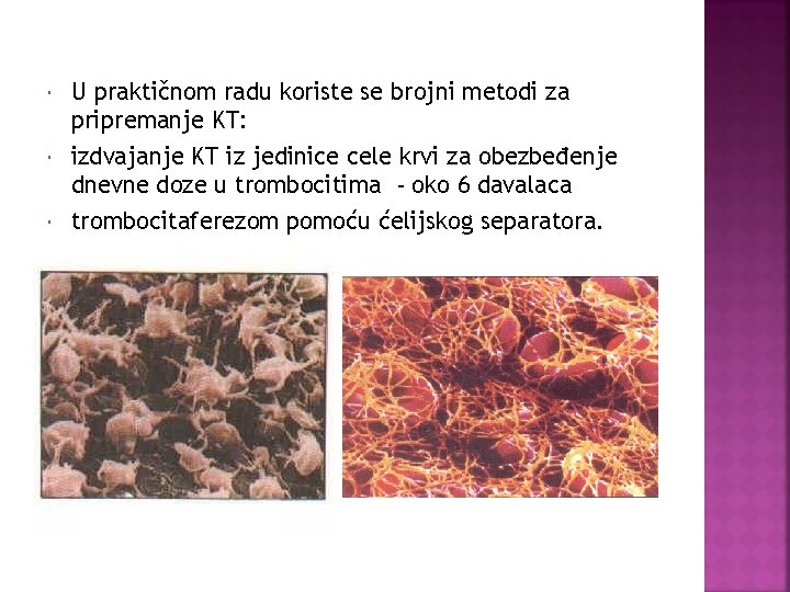  U praktičnom radu koriste se brojni metodi za pripremanje KT: izdvajanje KT iz