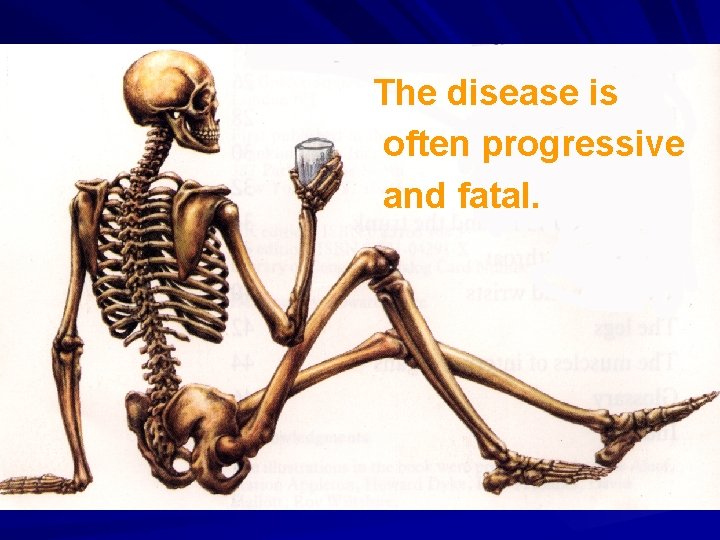 The disease is often progressive and fatal. 