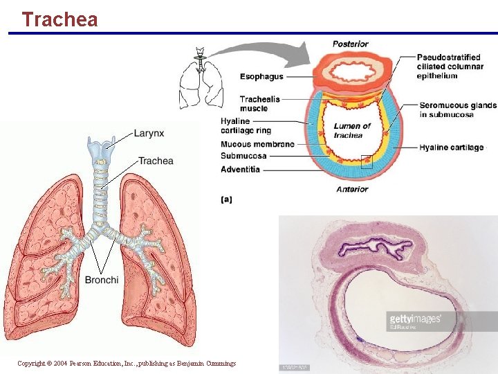 Trachea Figure 22. 6 a Copyright © 2004 Pearson Education, Inc. , publishing as