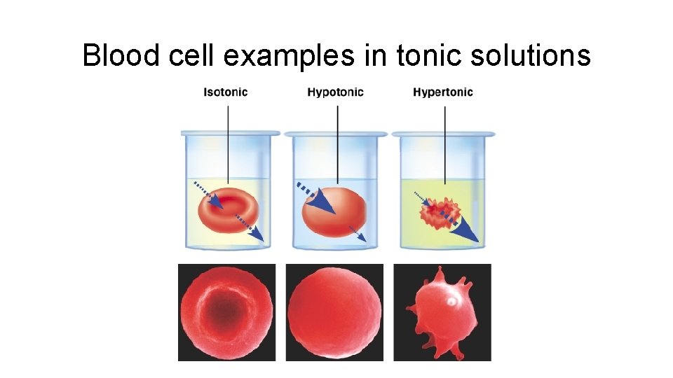 Blood cell examples in tonic solutions 