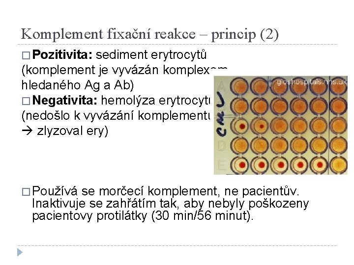 Komplement fixační reakce – princip (2) � Pozitivita: sediment erytrocytů (komplement je vyvázán komplexem