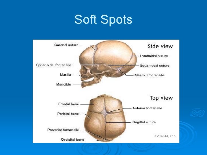 Soft Spots 