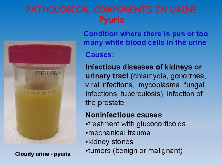 PATHOLOGICAL COMPONENTS IN URINE Pyuria Condition where there is pus or too many white