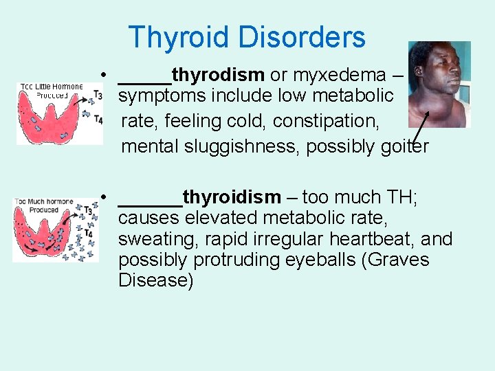 Thyroid Disorders • _____thyrodism or myxedema – symptoms include low metabolic rate, feeling cold,