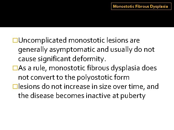 Monostotic Fibrous Dysplasia �Uncomplicated monostotic lesions are generally asymptomatic and usually do not cause