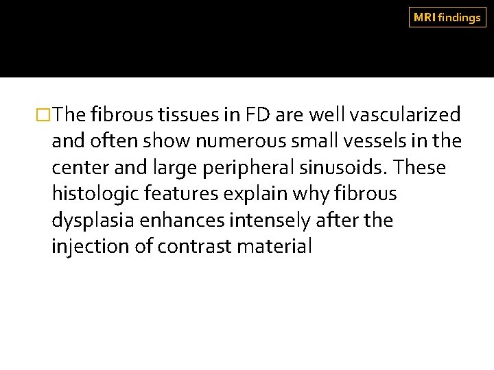 MRI findings �The fibrous tissues in FD are well vascularized and often show numerous