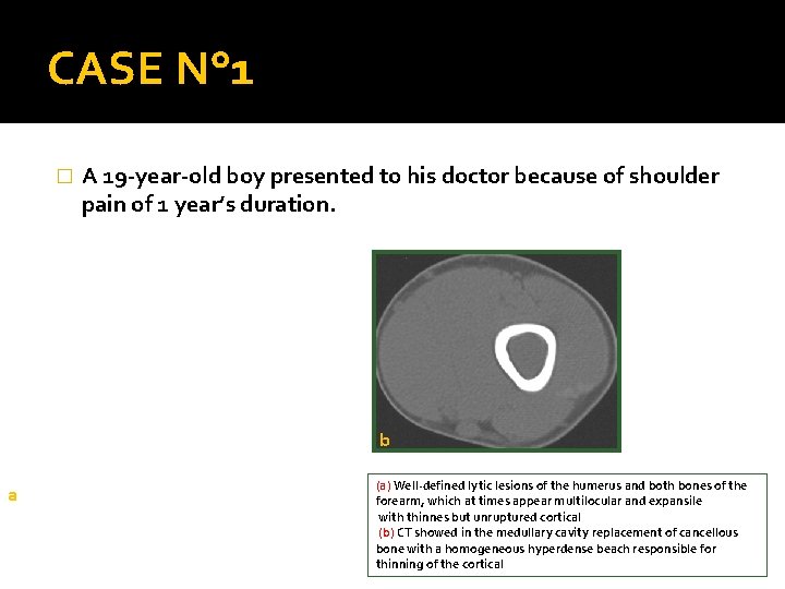 CASE N° 1 � A 19 -year-old boy presented to his doctor because of
