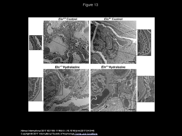 Figure 13 Kidney International 2017 921100 -1118 DOI: (10. 1016/j. kint. 2017. 044) Copyright