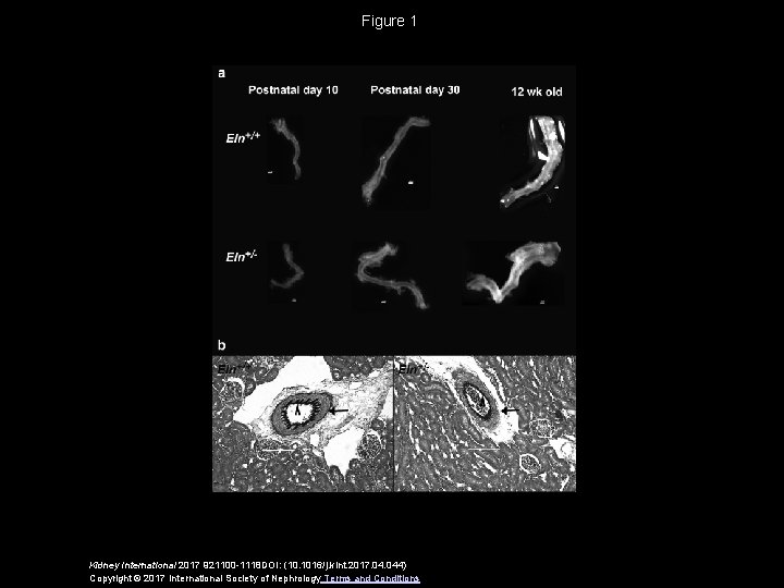 Figure 1 Kidney International 2017 921100 -1118 DOI: (10. 1016/j. kint. 2017. 044) Copyright