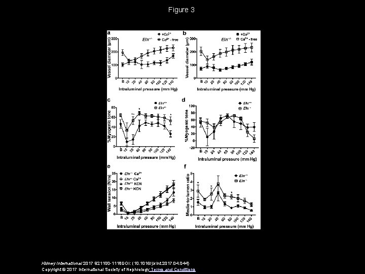 Figure 3 Kidney International 2017 921100 -1118 DOI: (10. 1016/j. kint. 2017. 044) Copyright