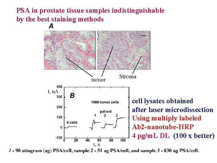 PSA in prostate tissue samples indistinguishable by the best staining methods cell lysates obtained