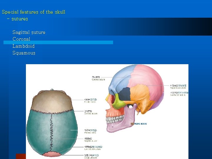 Special features of the skull - sutures Sagittal suture Coronal Lambdoid Squamous 