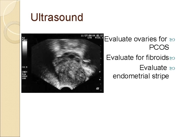 Ultrasound Evaluate ovaries for PCOS Evaluate for fibroids Evaluate endometrial stripe 