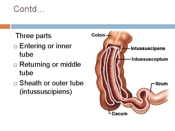 Contd… Three parts Entering or inner tube Returning or middle tube Sheath or outer