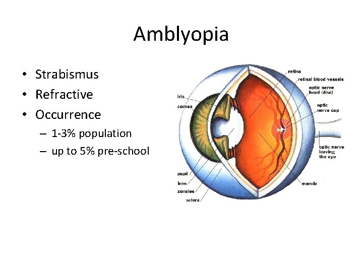 Amblyopia • Strabismus • Refractive • Occurrence – 1 -3% population – up to