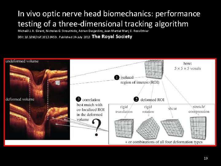 In vivo optic nerve head biomechanics: performance testing of a three-dimensional tracking algorithm Michaël