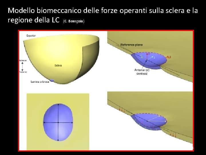 Modello biomeccanico delle forze operanti sulla sclera e la regione della LC (C. Bourgoin)