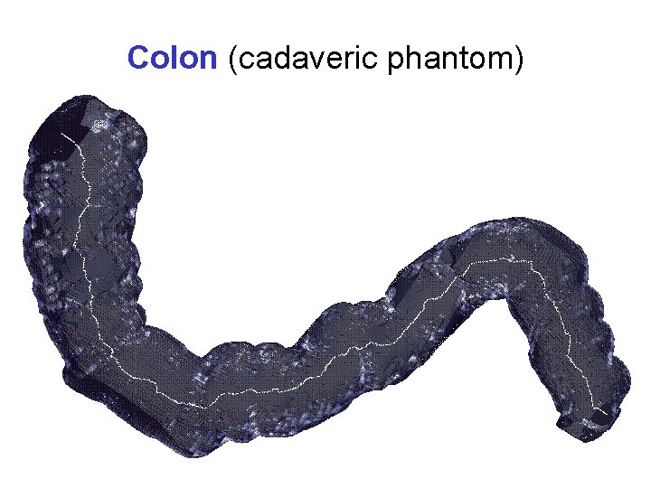 Colon (cadaveric phantom) 