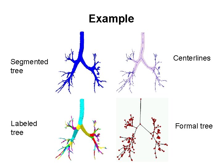 Example Segmented tree Labeled tree Centerlines Formal tree 