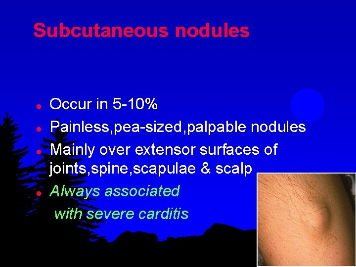 Subcutaneous nodules l l Occur in 5 -10% Painless, pea-sized, palpable nodules Mainly over