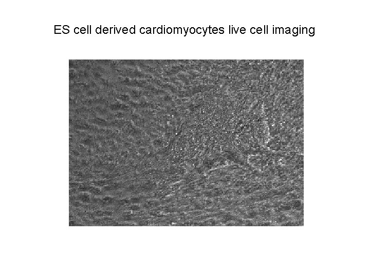 ES cell derived cardiomyocytes live cell imaging 