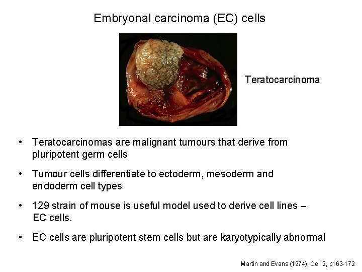 Embryonal carcinoma (EC) cells Teratocarcinoma • Teratocarcinomas are malignant tumours that derive from pluripotent