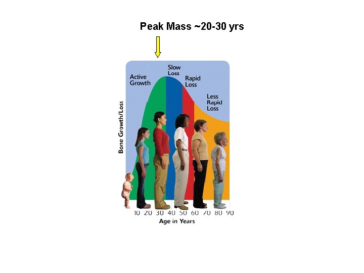 Peak Mass ~20 -30 yrs The Surgeon General’s report on bone health and osteoporosis: