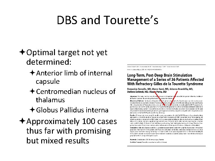 DBS and Tourette’s Optimal target not yet determined: Anterior limb of internal capsule Centromedian