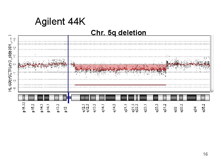 Agilent 44 K Chr. 5 q deletion 16 