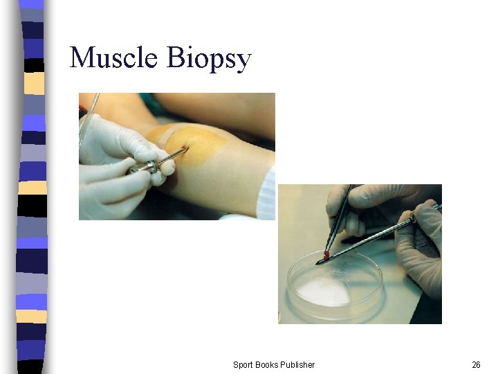 Muscle Biopsy Sport Books Publisher 26 