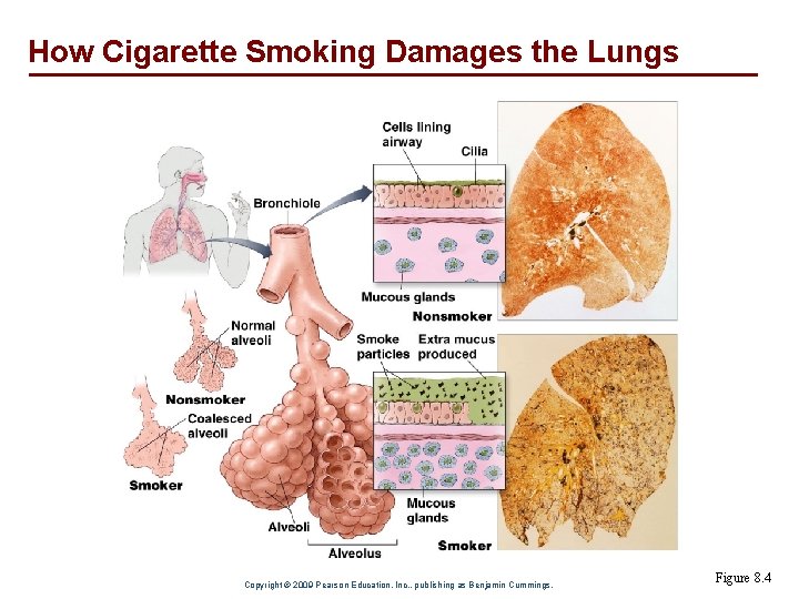 How Cigarette Smoking Damages the Lungs Copyright © 2009 Pearson Education, Inc. , publishing