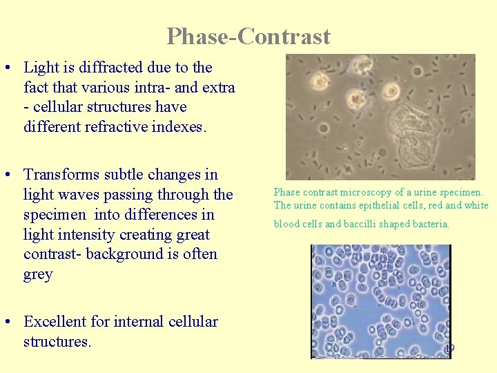 Phase-Contrast • Light is diffracted due to the fact that various intra- and extra