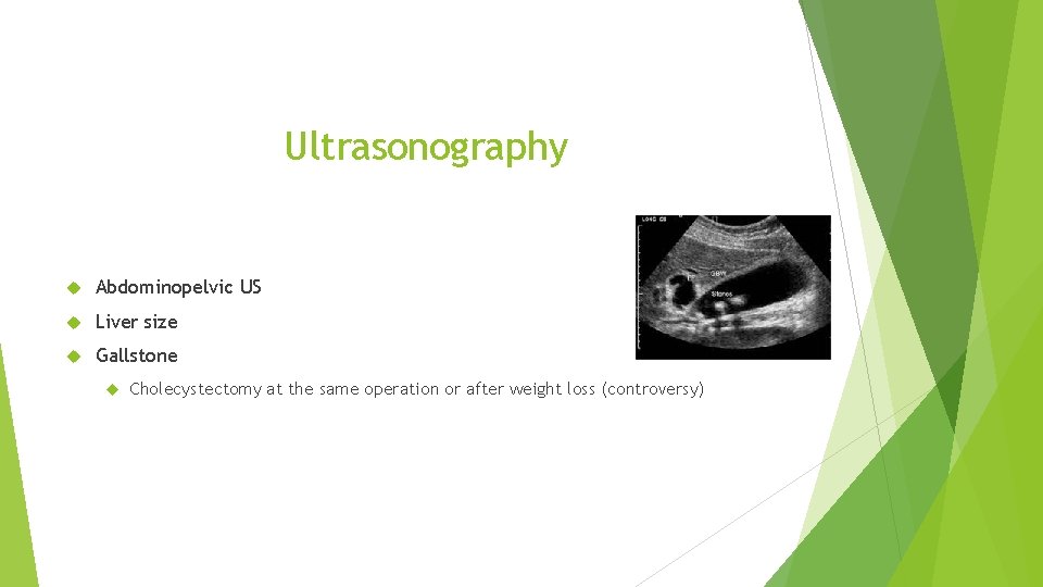 Ultrasonography Abdominopelvic US Liver size Gallstone Cholecystectomy at the same operation or after weight