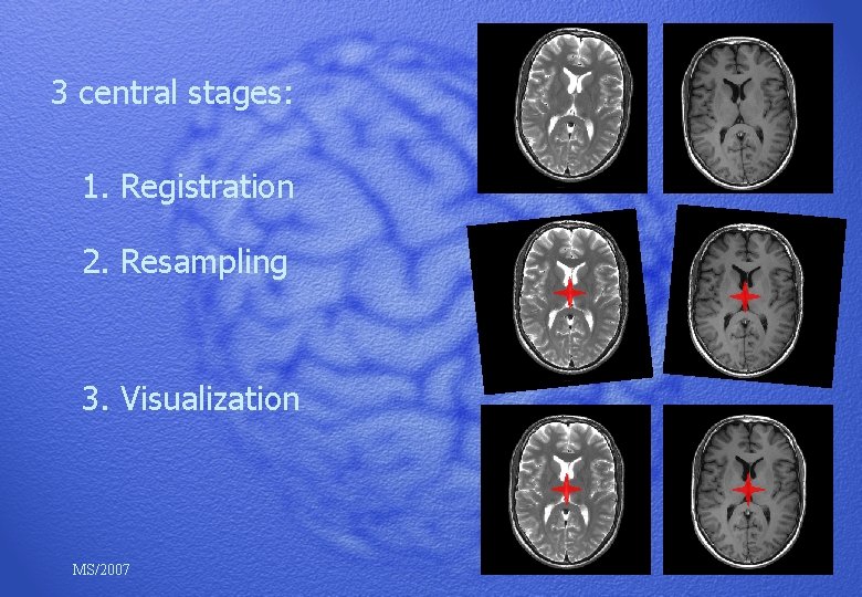 3 central stages: 1. Registration 2. Resampling 3. Visualization MS/2007 
