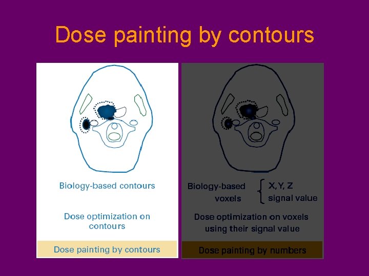 Dose painting by contours 