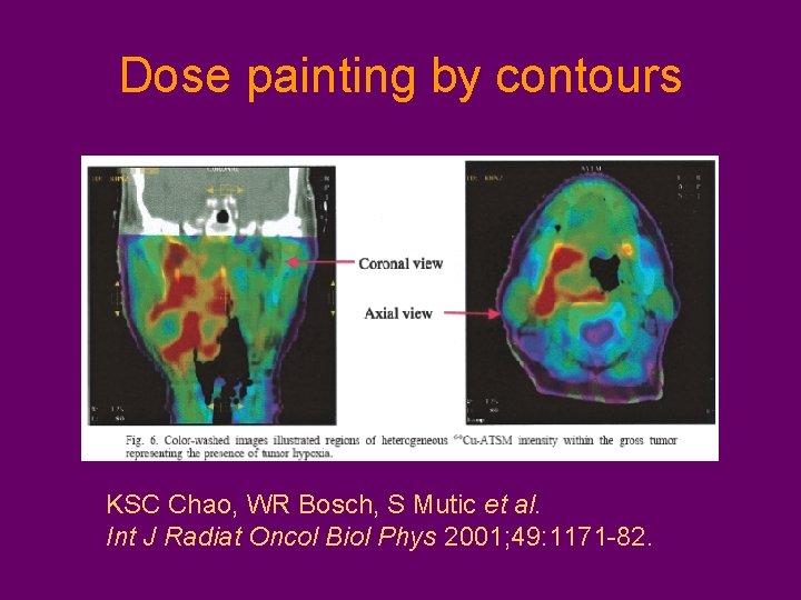 Dose painting by contours KSC Chao, WR Bosch, S Mutic et al. Int J