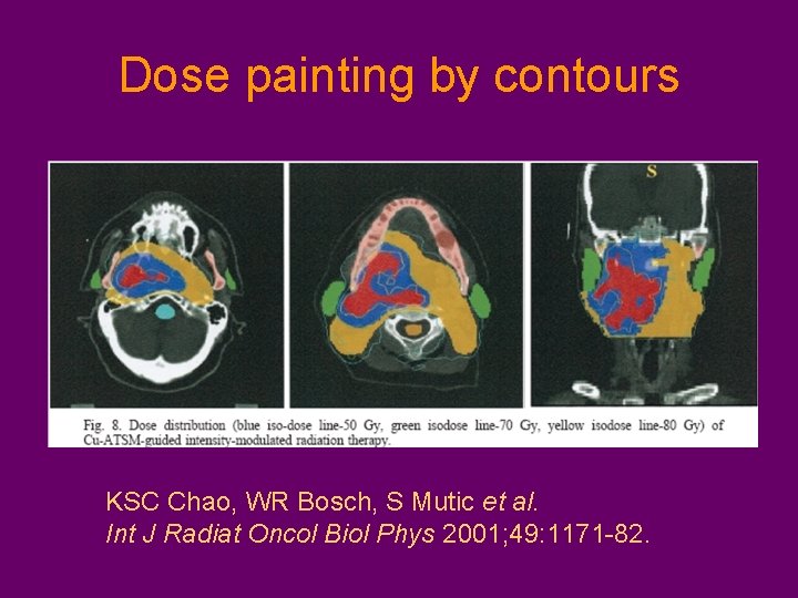 Dose painting by contours KSC Chao, WR Bosch, S Mutic et al. Int J