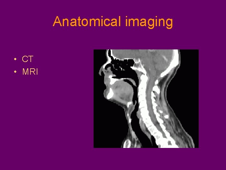 Anatomical imaging • CT • MRI 
