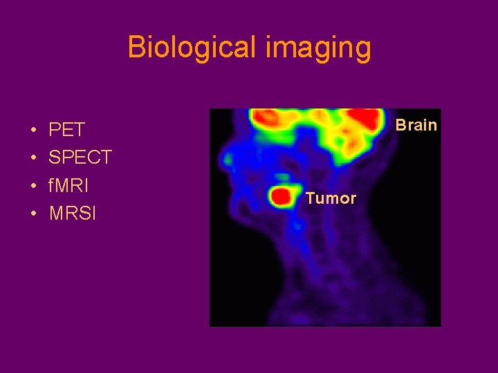 Biological imaging • • PET SPECT f. MRI MRSI Brain Tumor 