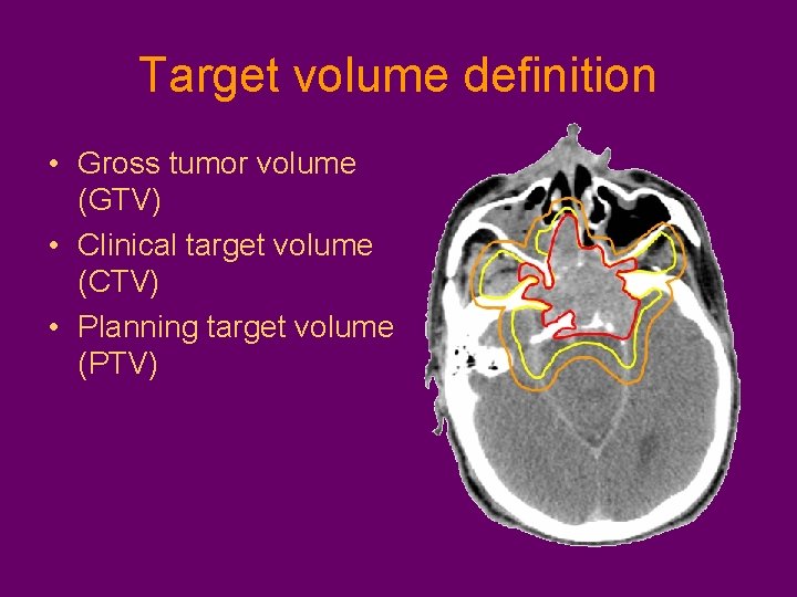 Target volume definition • Gross tumor volume (GTV) • Clinical target volume (CTV) •