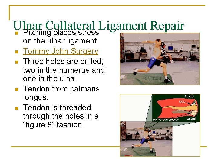 Ulnar Collateral Ligament Repair n Pitching places stress n n on the ulnar ligament