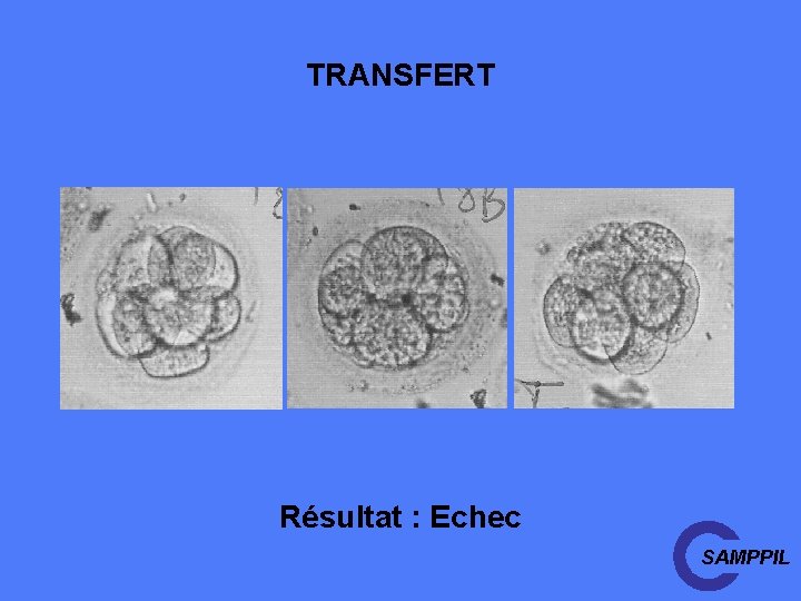 TRANSFERT Résultat : Echec SAMPPIL 