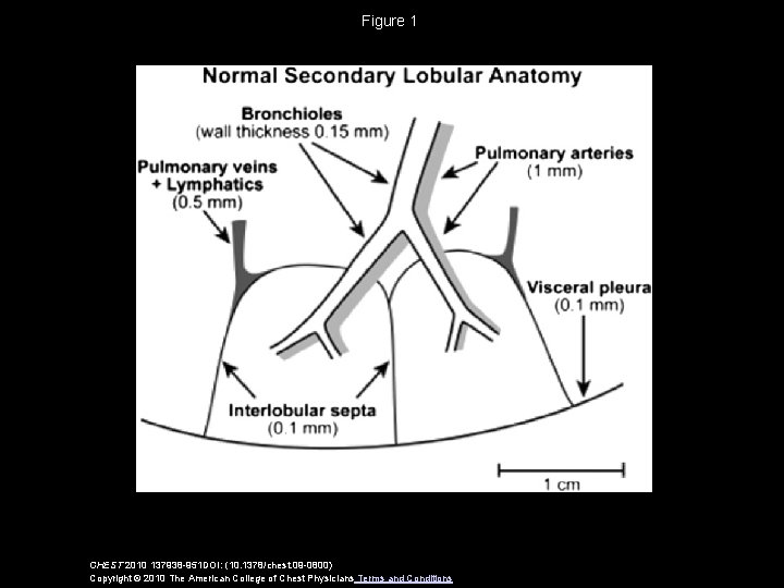 Figure 1 CHEST 2010 137938 -951 DOI: (10. 1378/chest. 09 -0800) Copyright © 2010