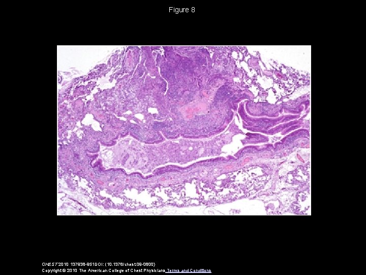 Figure 8 CHEST 2010 137938 -951 DOI: (10. 1378/chest. 09 -0800) Copyright © 2010