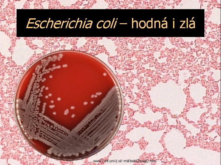 Escherichia coli – hodná i zlá www 2. mf. uni-lj. si/~mil/bakt 2. htm 