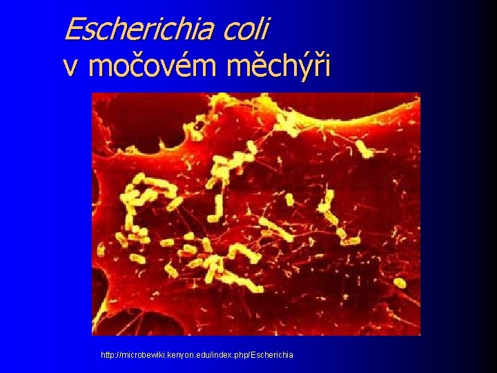 Escherichia coli v močovém měchýři http: //microbewiki. kenyon. edu/index. php/Escherichia 
