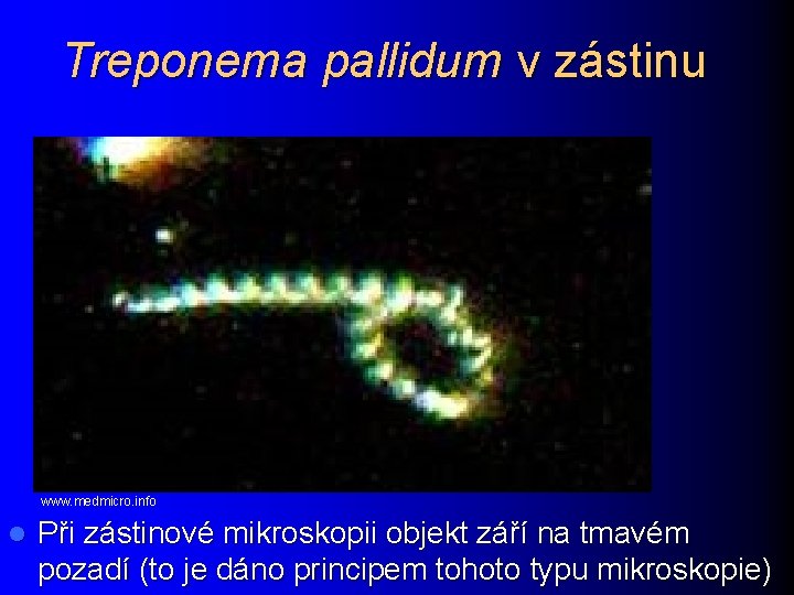 Treponema pallidum v zástinu www. medmicro. info l Při zástinové mikroskopii objekt září na