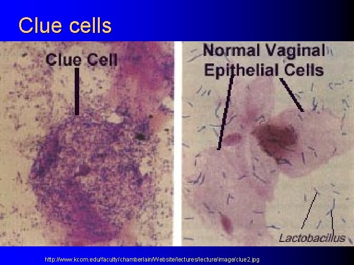 Clue cells http: //www. kcom. edu/faculty/chamberlain/Website/lectures/lecture/image/clue 2. jpg 