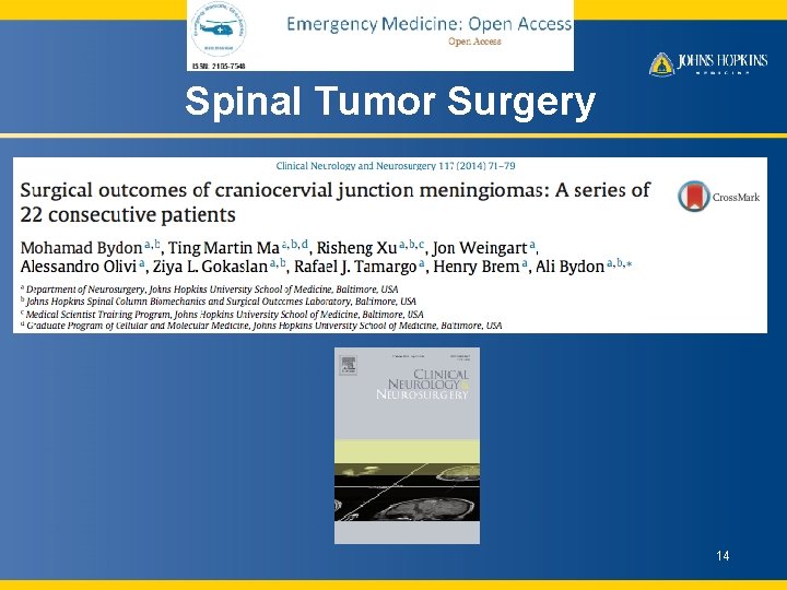 Spinal Tumor Surgery 14 